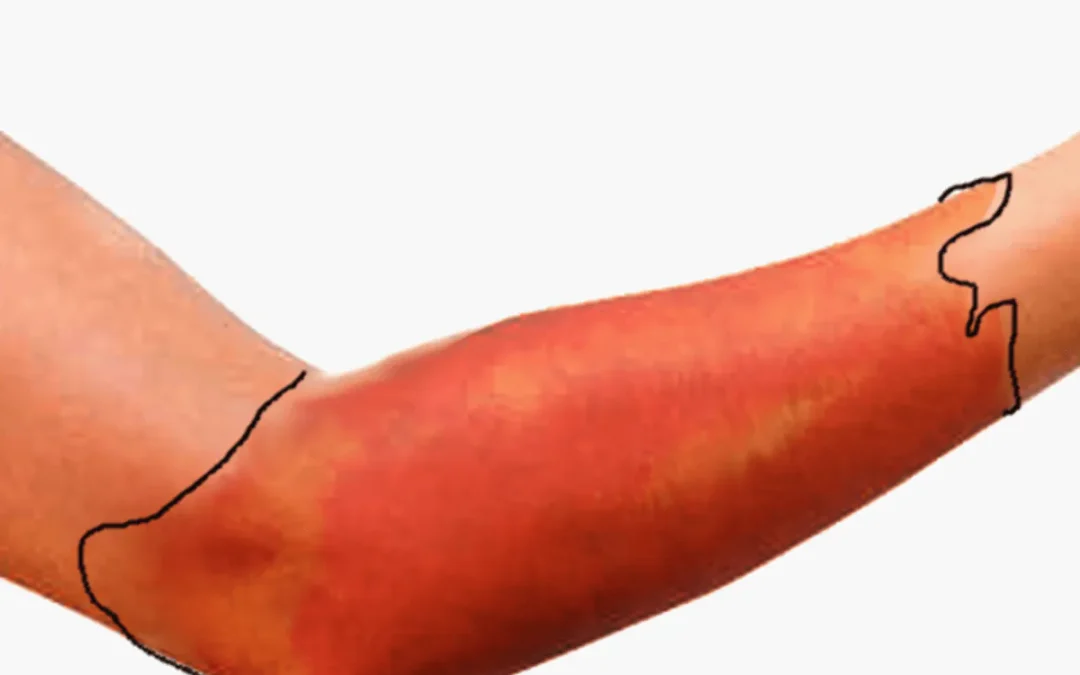 Kada se zbog crvenog vjetra mora reagirati odmah i zašto odgađanje može imati posljedice