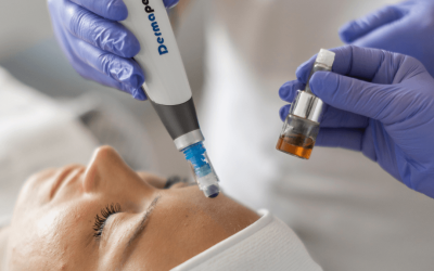 Kako djeluje PBSerum i koje estetske probleme može učinkovito riješiti